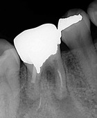 歯科用ＣＴの画像1